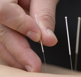 Eczeem – Acupuncturisten Overzicht